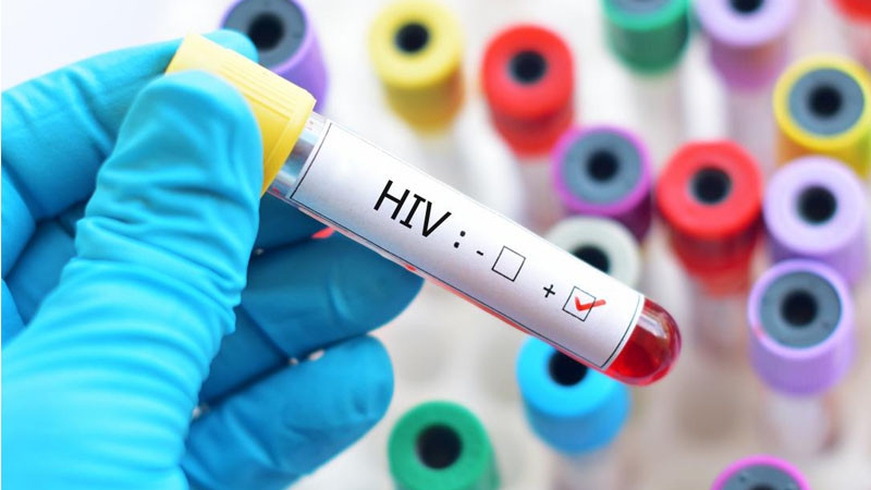 एचआईभी संक्रमण र यौन स्वास्थ्य